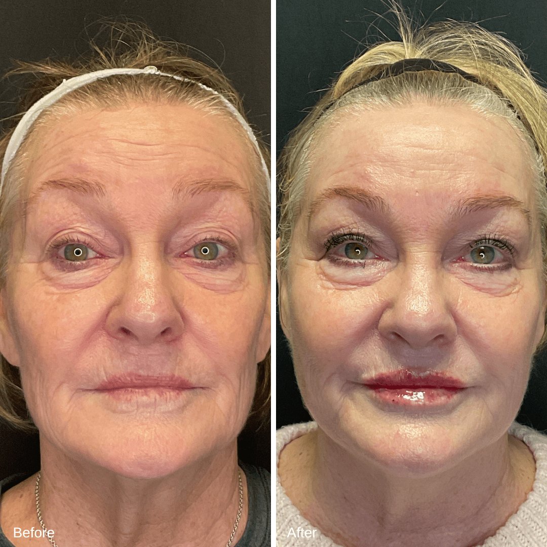 Denise Weber Filler
