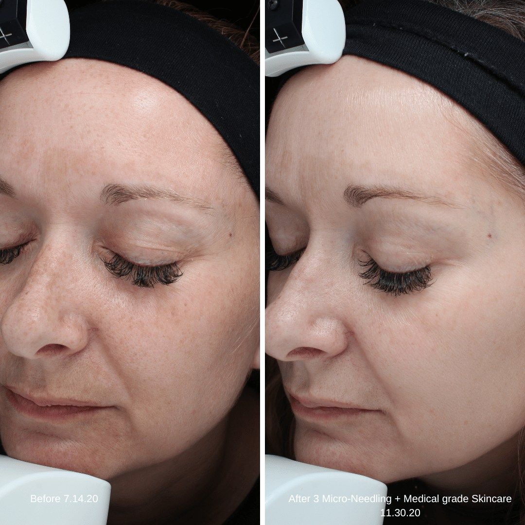 Melinda Seering MN Skincare Oblique