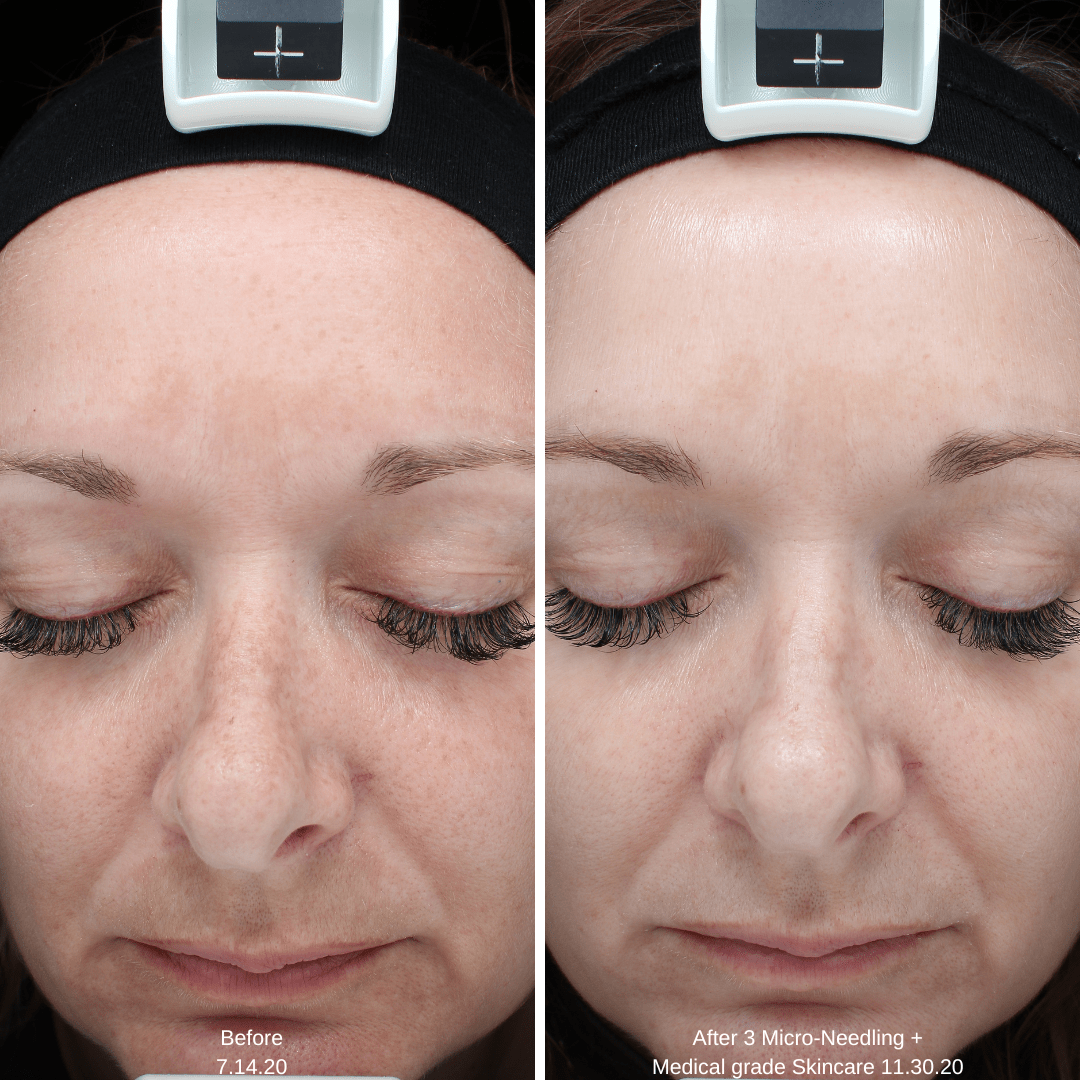 Melinda Seering MN Skin Front