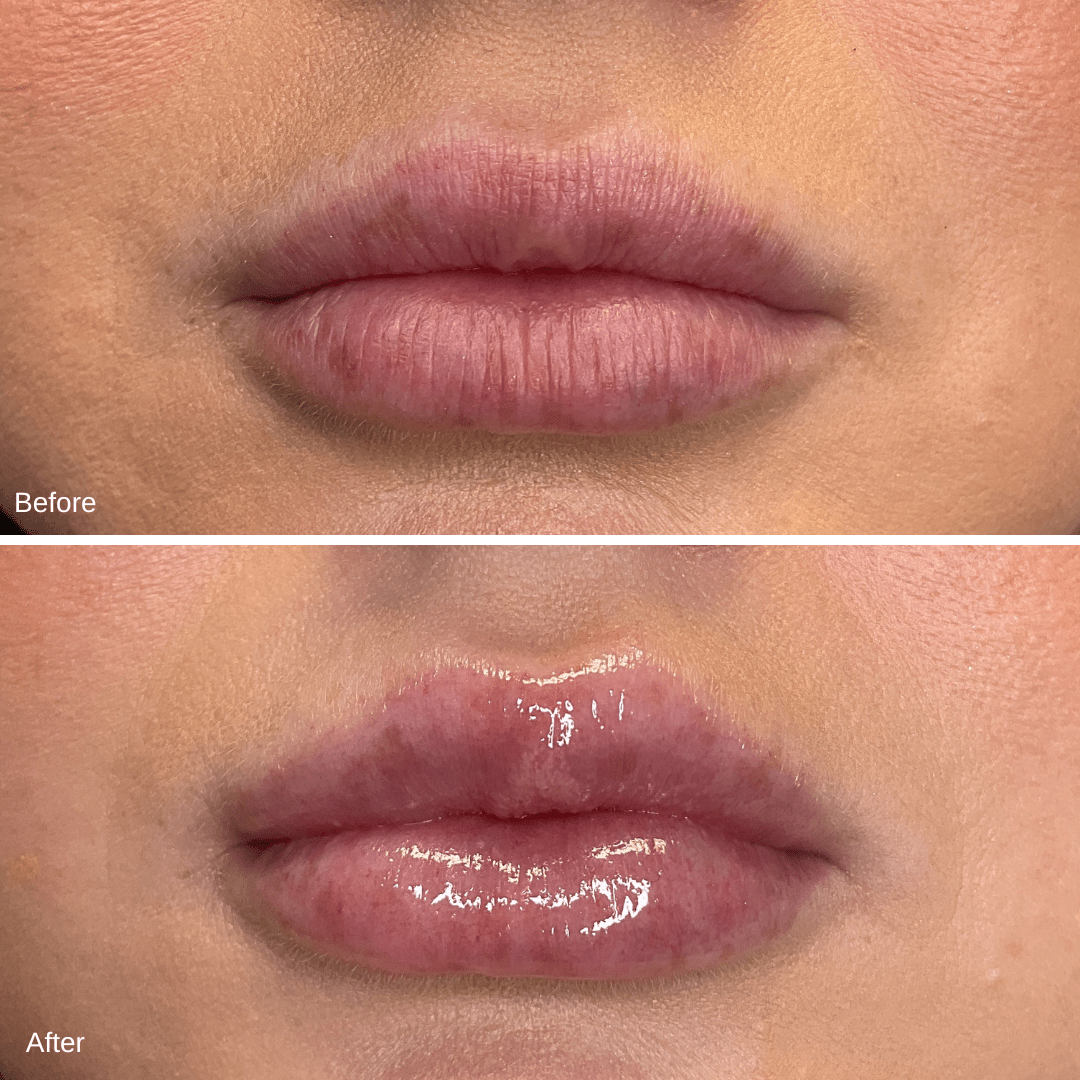 Jorden Morris Lips