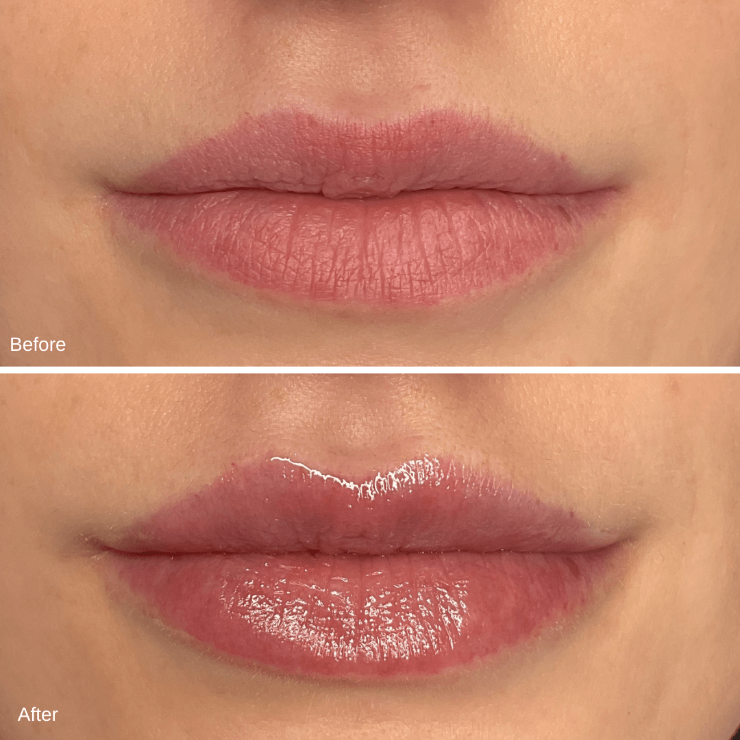 Megan Kanke Lips